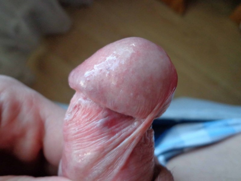 Головка члена крупным планом