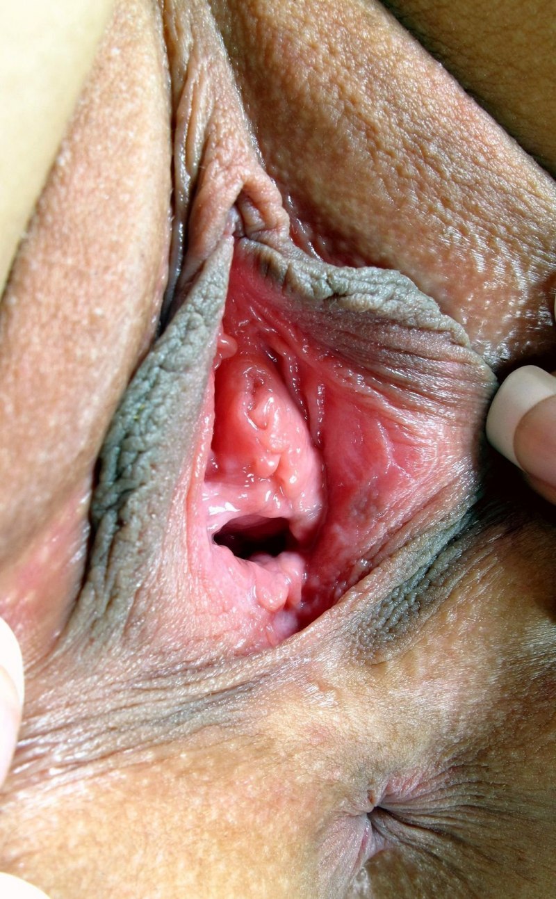 Крупные женские гениталии