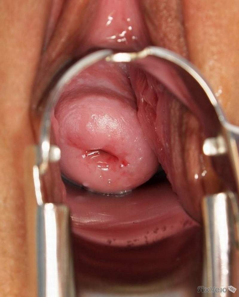 Слизни инфляция хентай x-ray