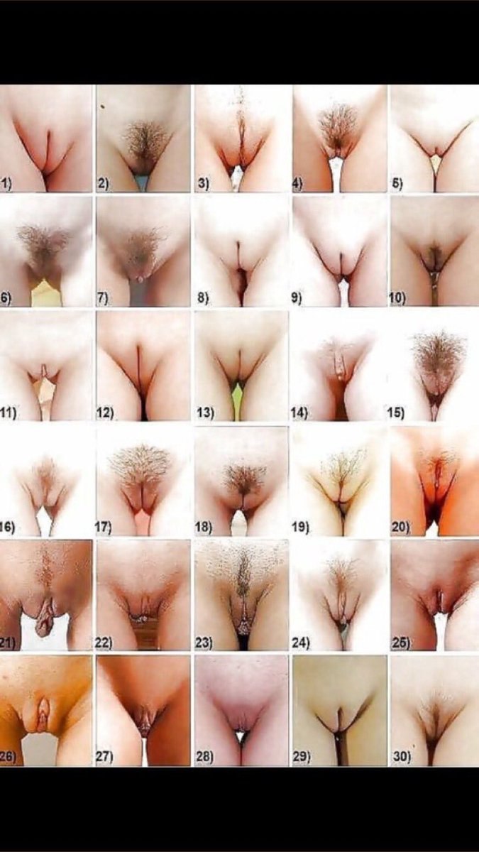 Формы женских половых органов