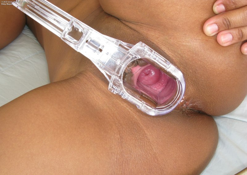 Гинекологические инструменты во влагалище