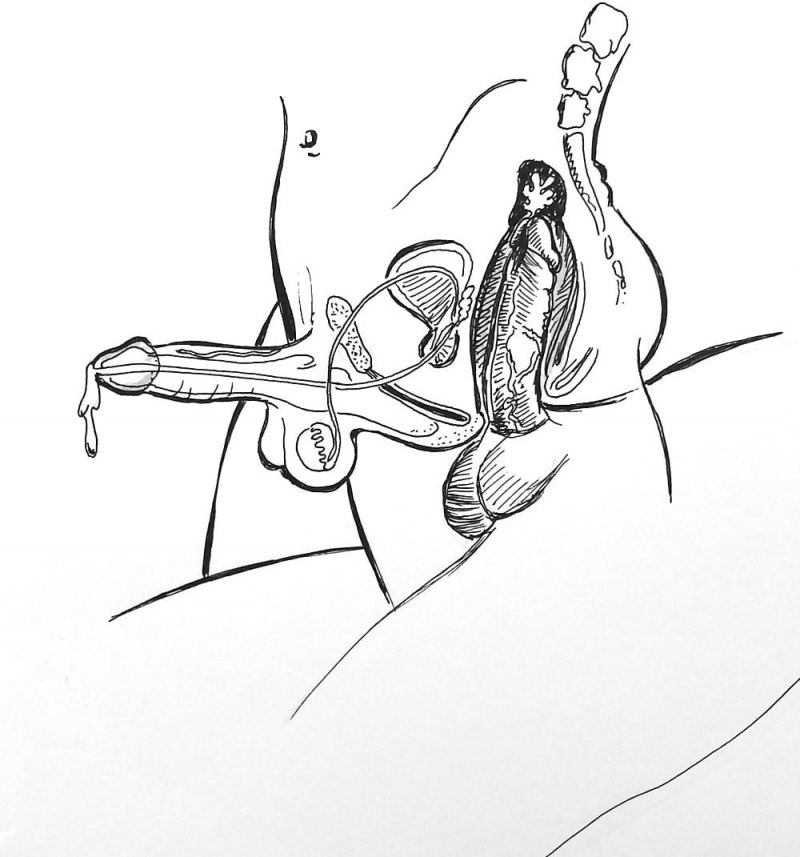 Анальный половой акт в разрезе