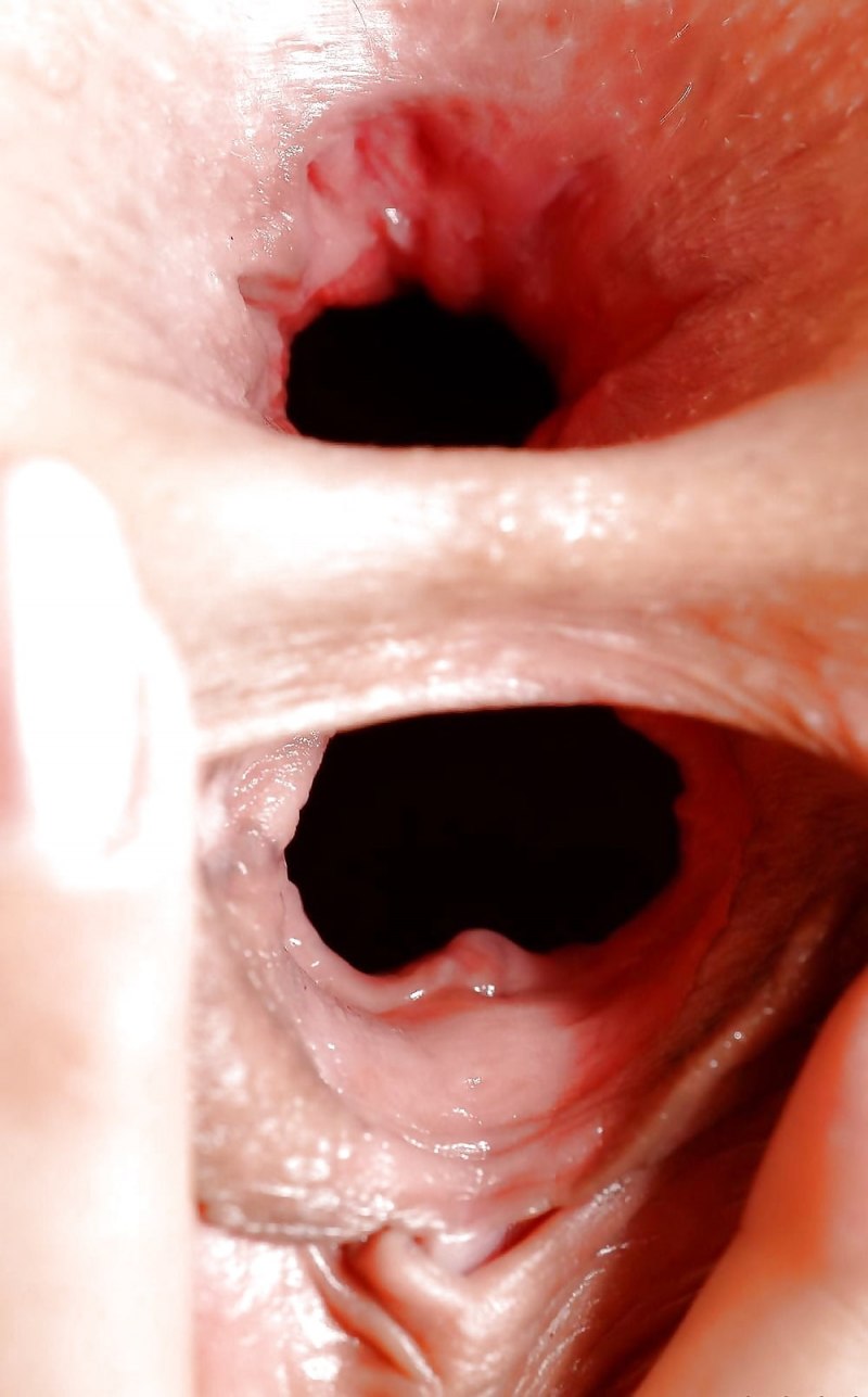 Женское влагалище изнутри