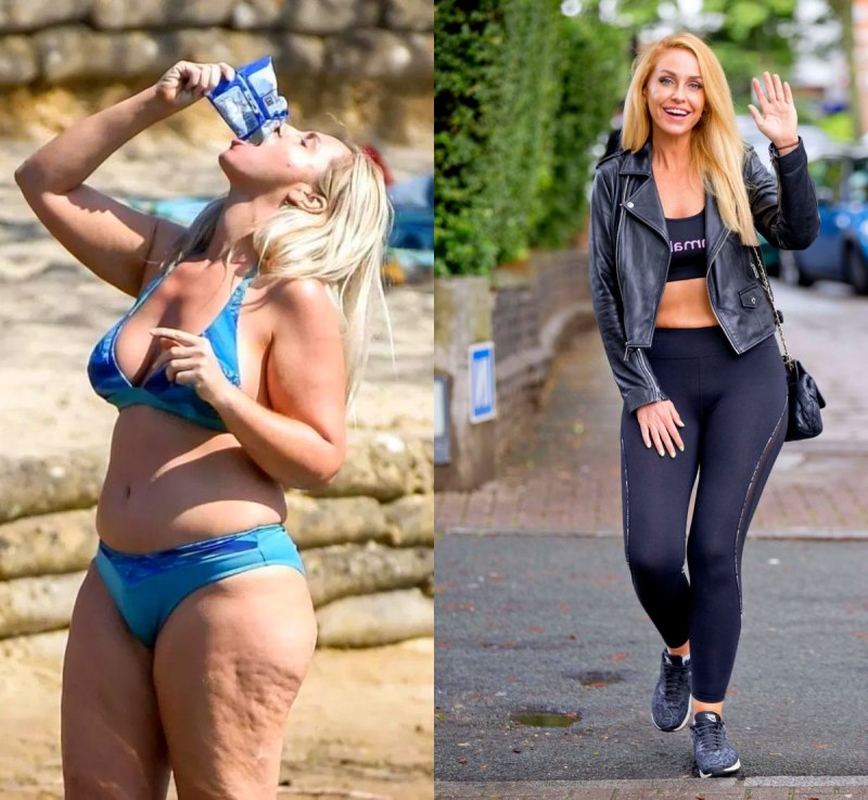 Джози Гибсон целлюлит