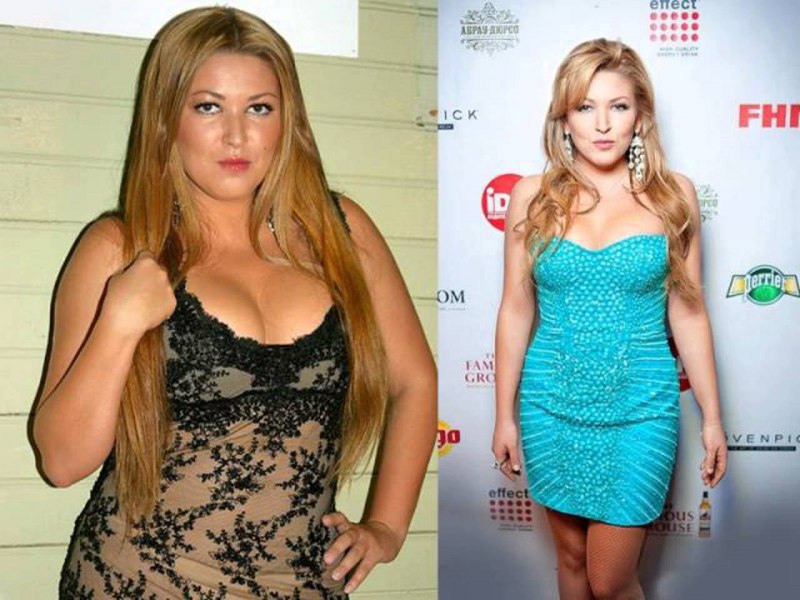 Ирина Дубцова до и после