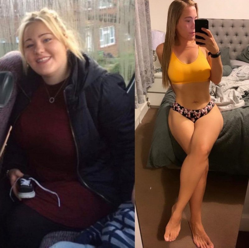 Роза Сябитова до пластики