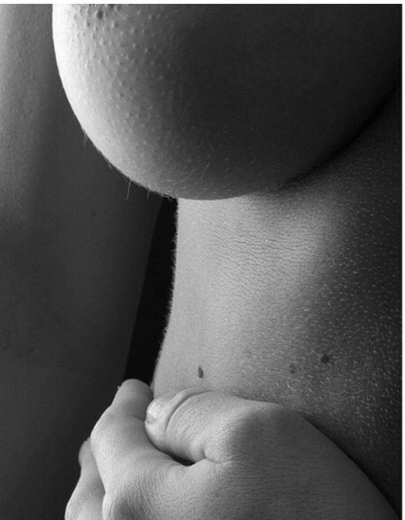 Голое женское тело в мурашках