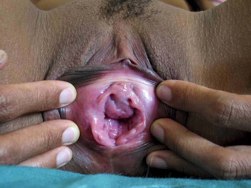 Здоровое влагалище внутри