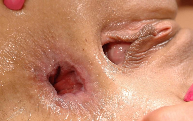 Анальное отверстие крупным планом