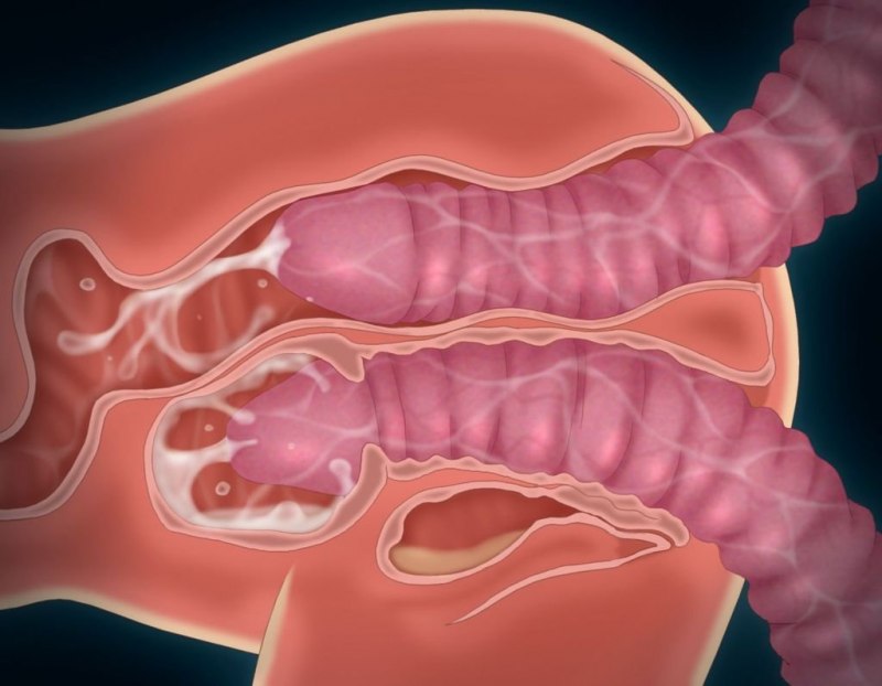 Влагалище изнутри в разрезе