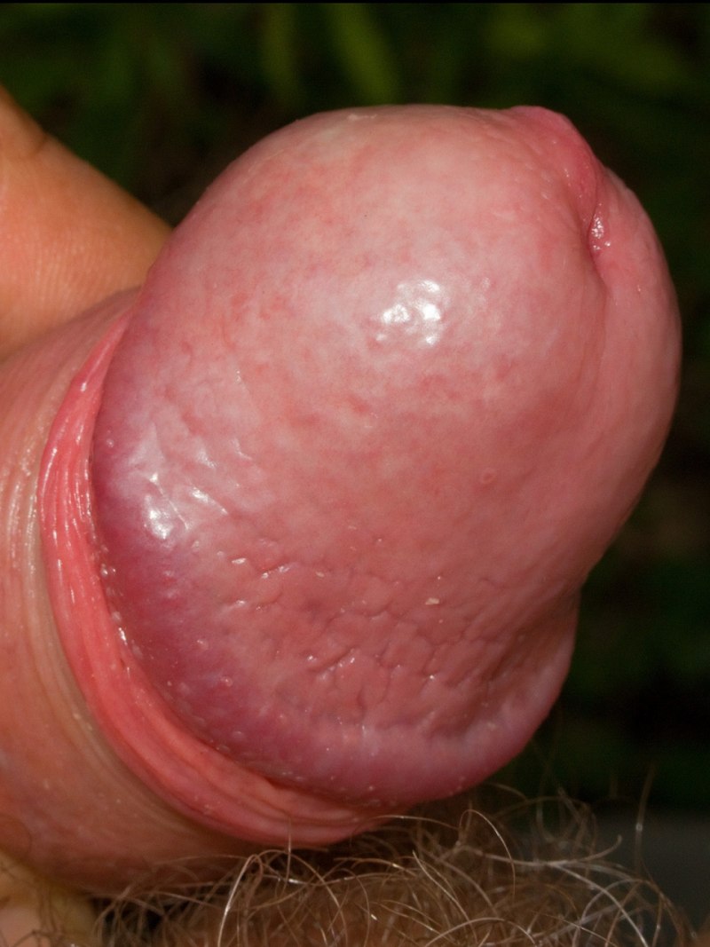 Здоровый половой член головка