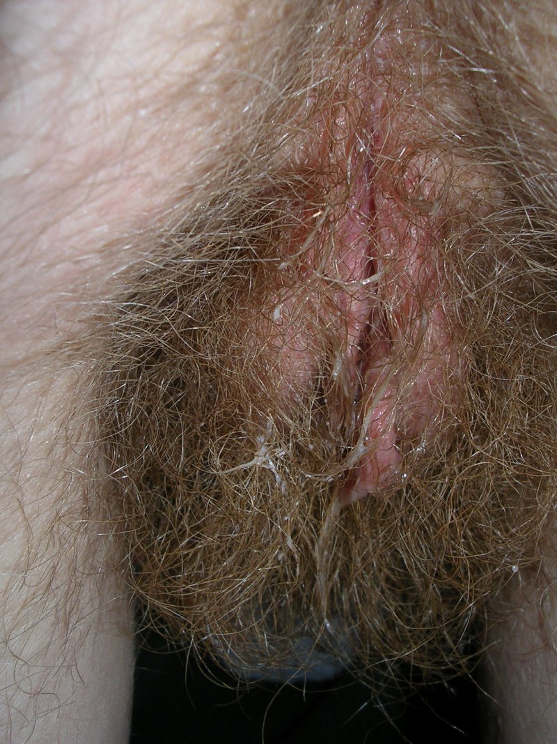 Большая волосатая вульва