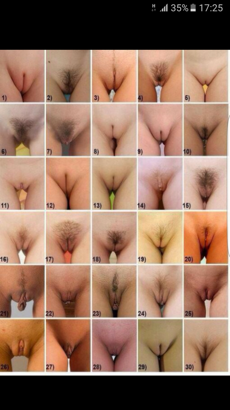 Формы женских половых органов