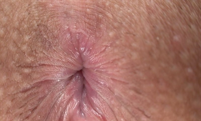 Анальное отверстие мужчины