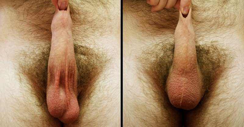 Мужские половые члены без яичек