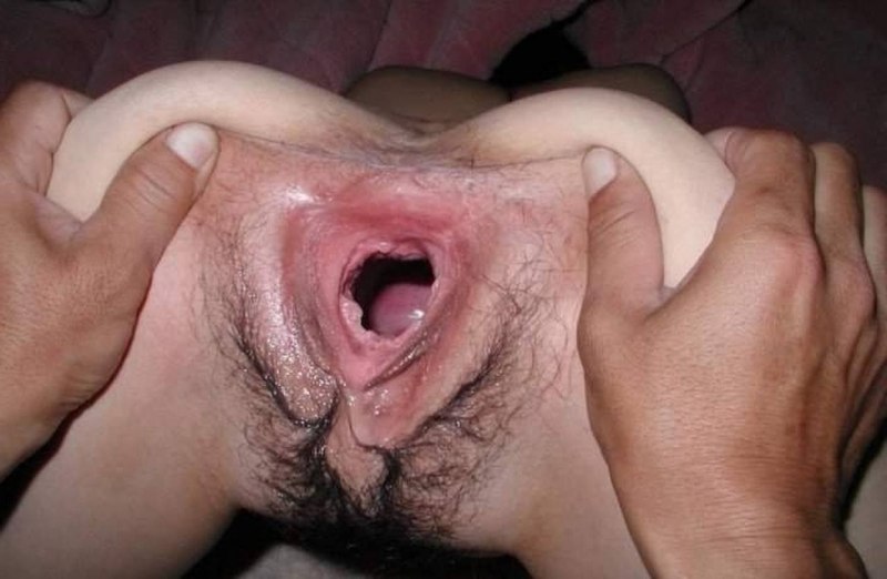 Огромные дыры влагалища