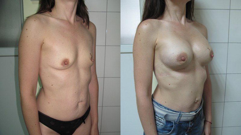 Голые сиськи третьего размера