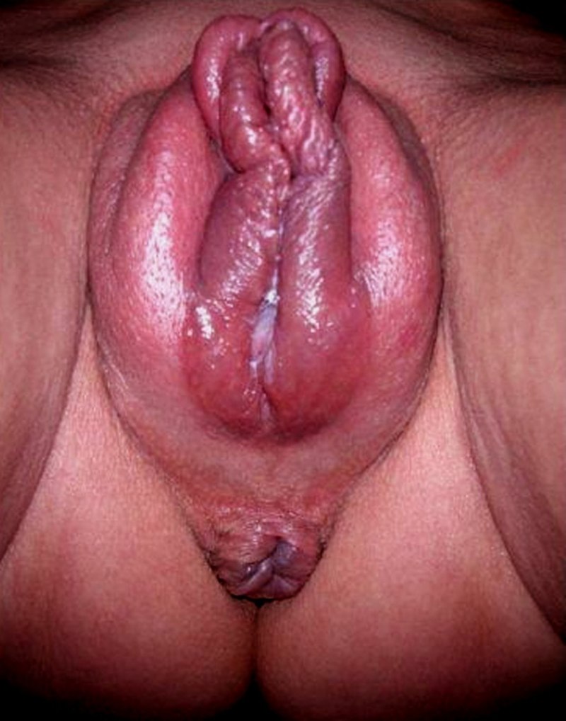 Огромные половые губы после помпы